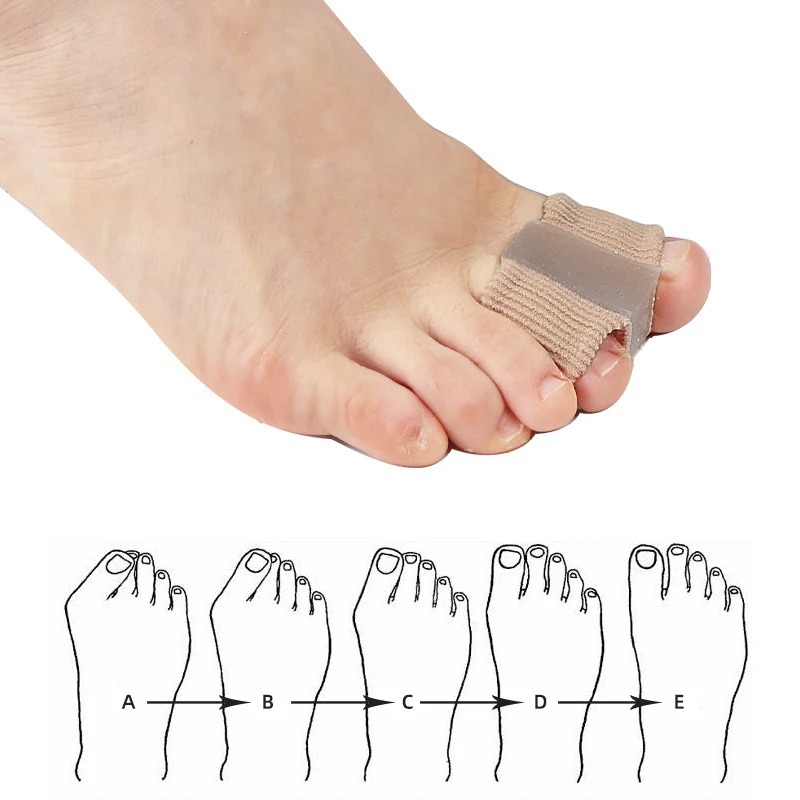 4PC Silicone Toe Separator Fin - Yoga Toe Separator recension och pris