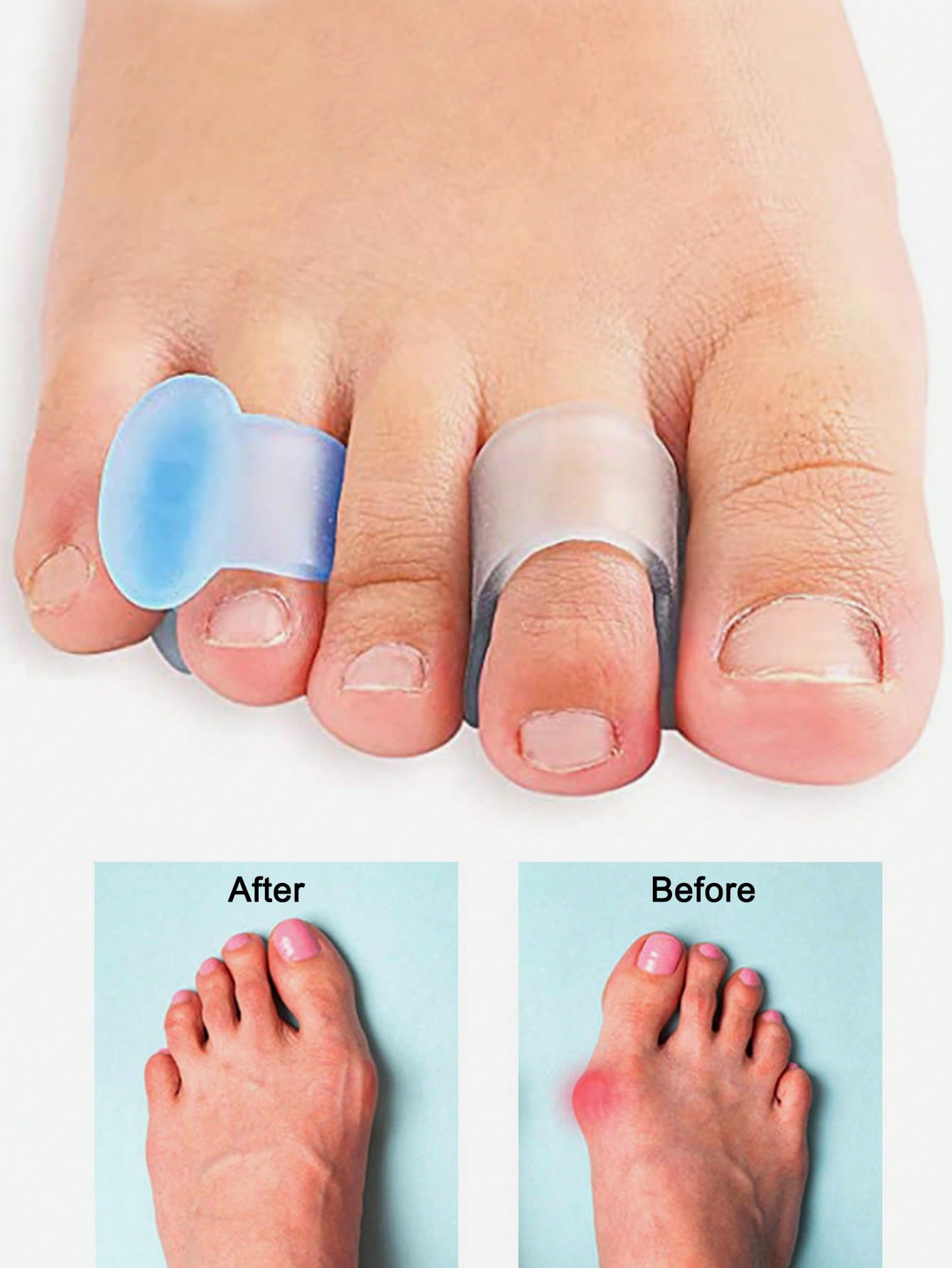 Gel Toe Separator, 4pcs Silico - Yoga Toe Separator recension och pris